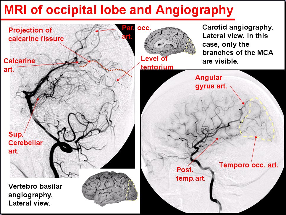 Salamons Neuroanatomy And Neurovasculature Web Atlas Resource